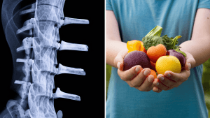 Unraveling the Complexities of Osteoporosis: A Comprehensive Guide to Bone Health