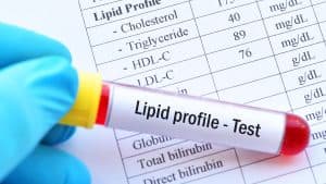 Unraveling the Complexities of Lipid Transport and Cholesterol Regulation