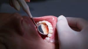 The Oral-Systemic Health Connection: The Importance of Caring for Your Mouth and Body